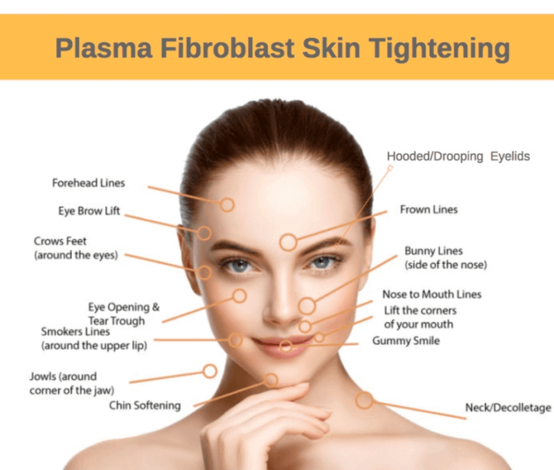 Fibroblast Plasma Skin Lifts Lux Beautique